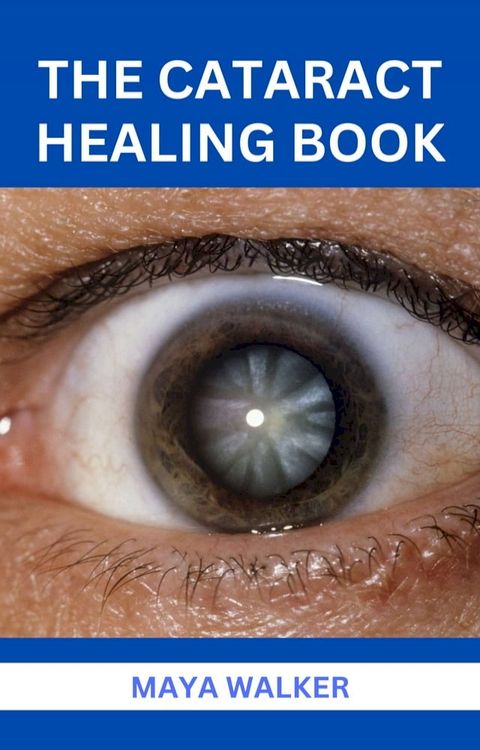 THE CATARACT HEALING BOOK(Kobo/電子書)