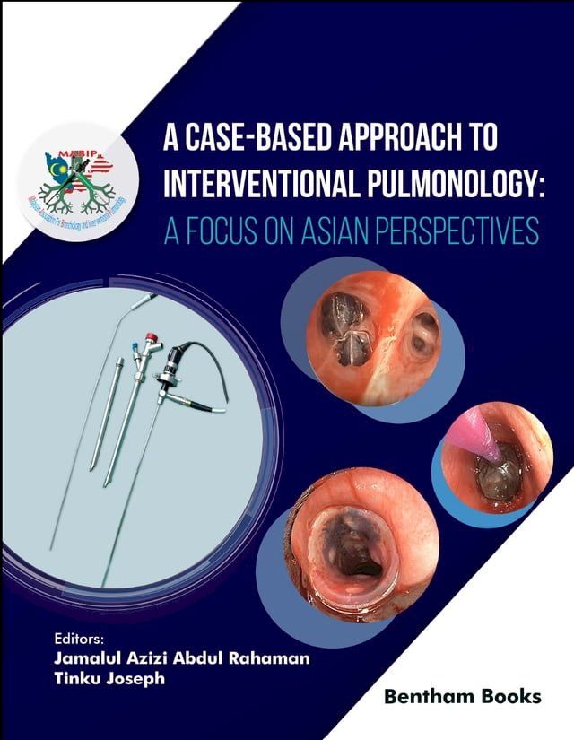  A Case-Based Approach to Interventional Pulmonology: A Focus on Asian Perspectives(Kobo/電子書)