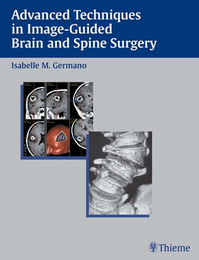  Advanced Techniques in Image-Guided Brain and Spine Surgery(Kobo/電子書)