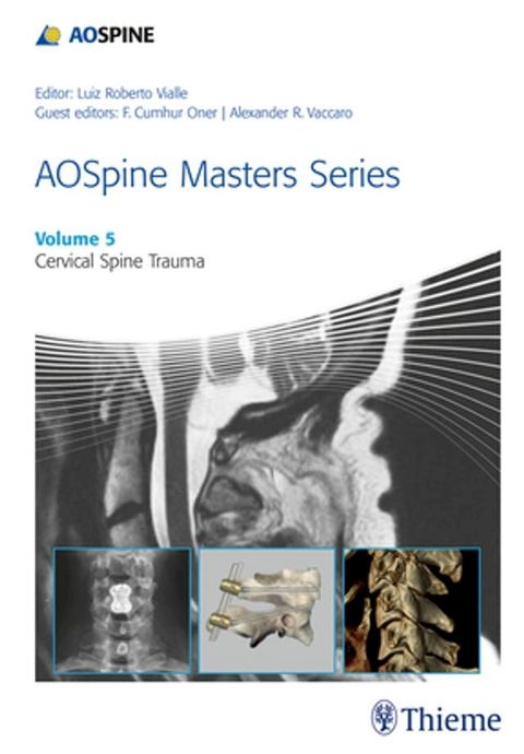 AOSpine Masters Series, Volume 5: Cervical Spine Trauma(Kobo/電子書)