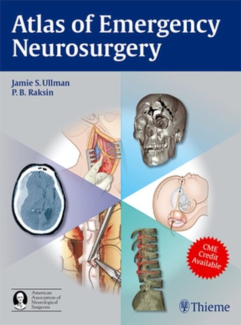 Atlas of Emergency Neurosurgery(Kobo/電子書)