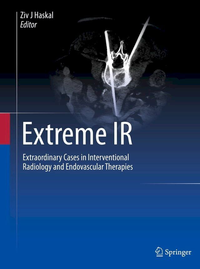  Extreme IR(Kobo/電子書)