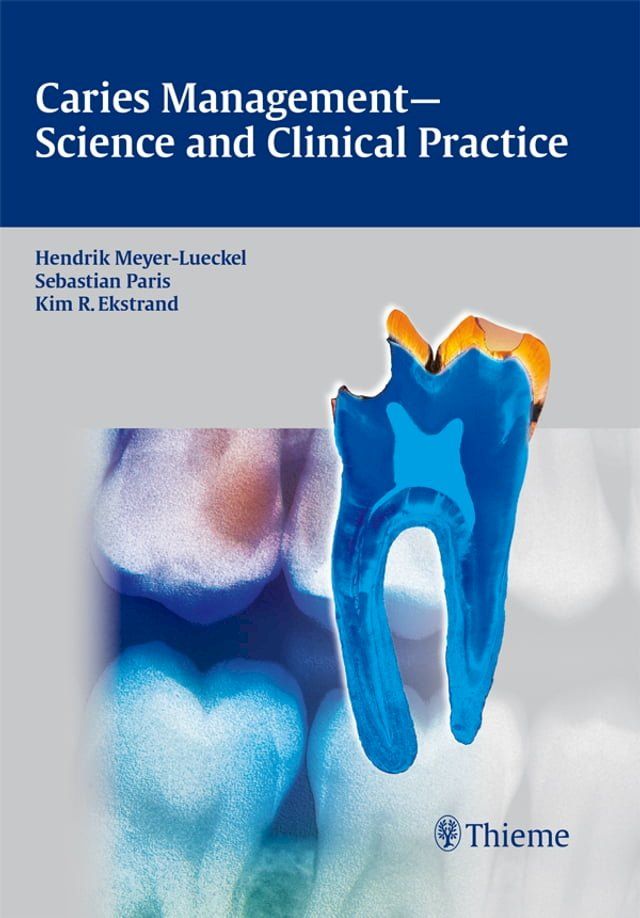  Caries Management - Science and Clinical Practice(Kobo/電子書)