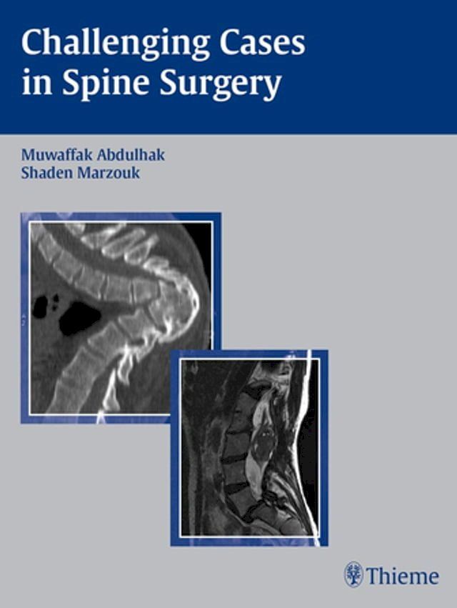  Challenging Cases in Spine Surgery(Kobo/電子書)