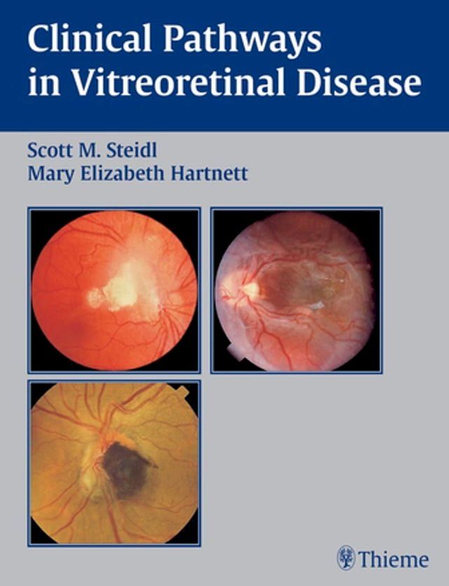  Clinical Pathways In Vitreoretinal Disease(Kobo/電子書)