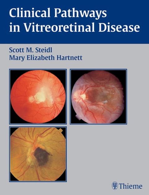 Clinical Pathways In Vitreoretinal Disease(Kobo/電子書)