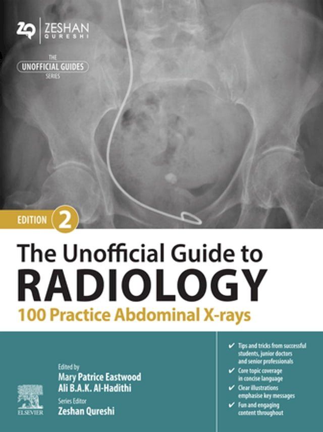  The Unofficial Guide to Radiology: 100 Practice Abdominal X-rays(Kobo/電子書)