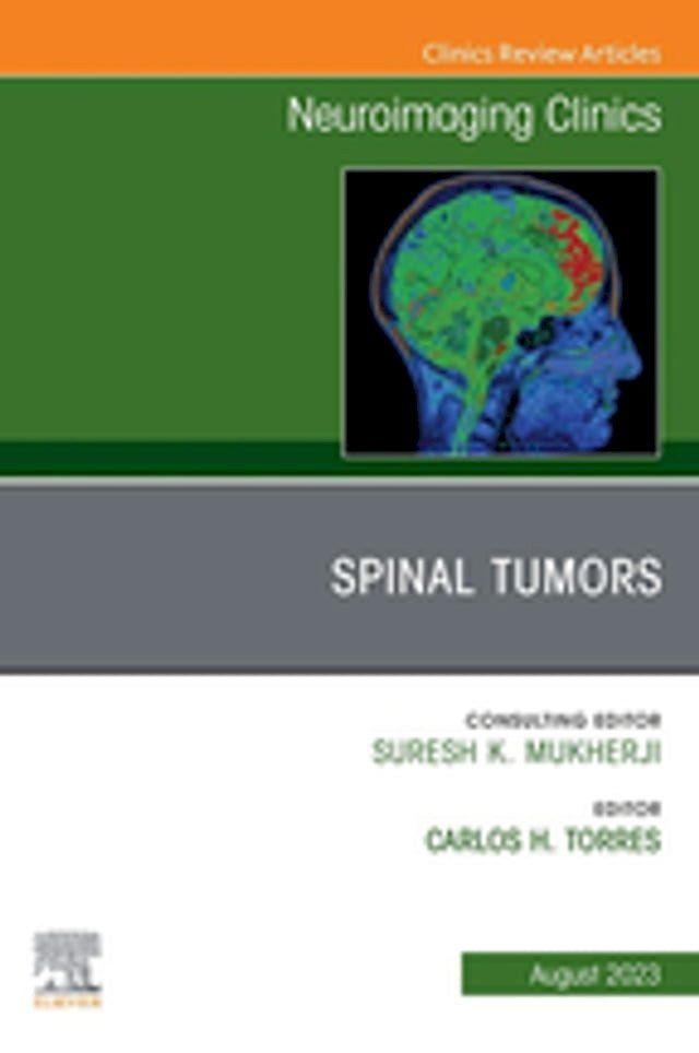  Spinal Tumors, An Issue of Neuroimaging Clinics of North America, E-Book(Kobo/電子書)