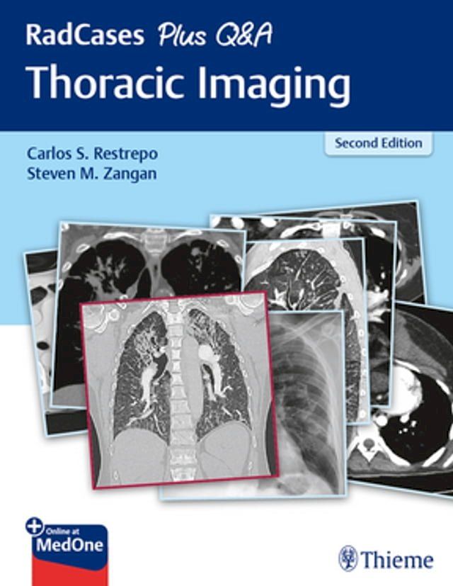  RadCases Plus Q&A Thoracic Imaging(Kobo/電子書)