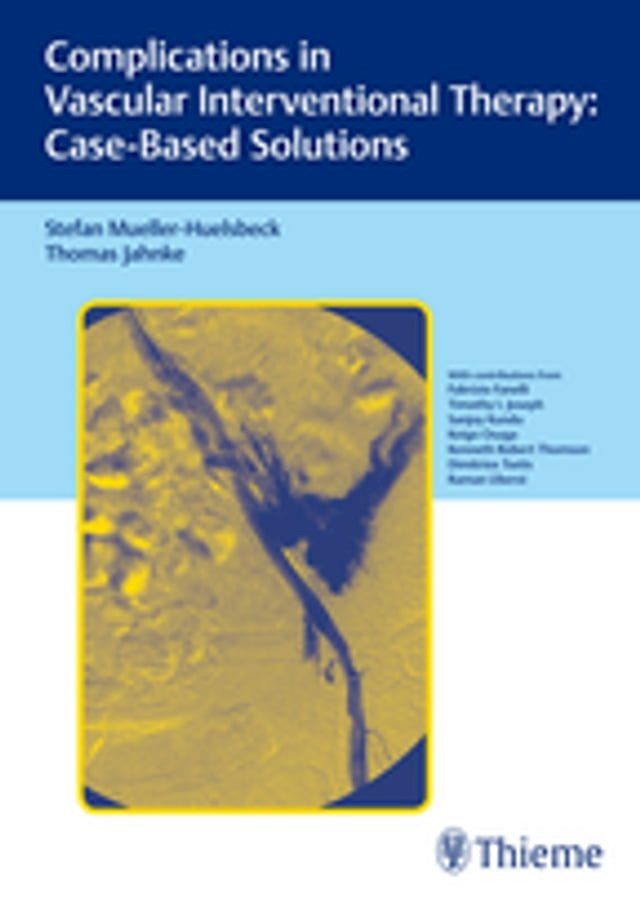  Complications in Vascular Interventional Therapy: Case-Based Solutions(Kobo/電子書)