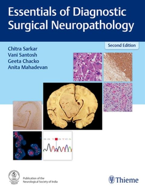 Essentials of Diagnostic Surgical Neuropathology(Kobo/電子書)