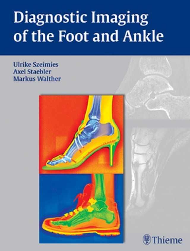  Diagnostic Imaging of the Foot and Ankle(Kobo/電子書)