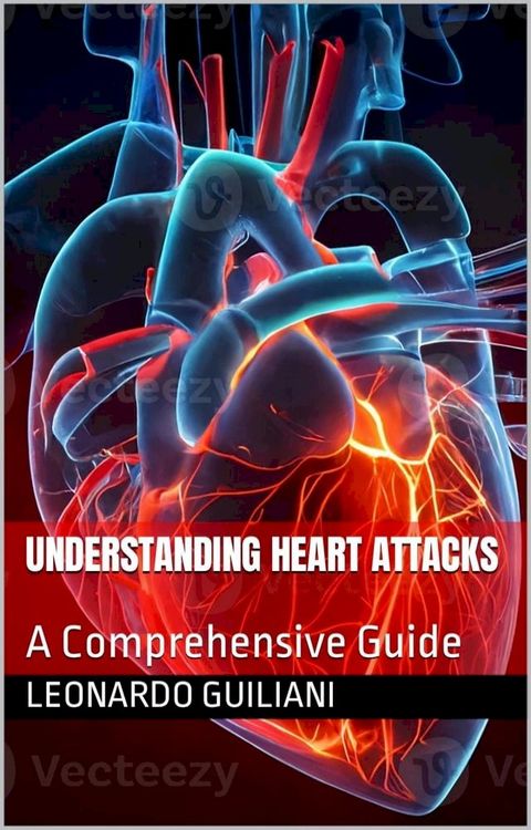 Understanding Heart Attacks A Comprehensive Guide(Kobo/電子書)