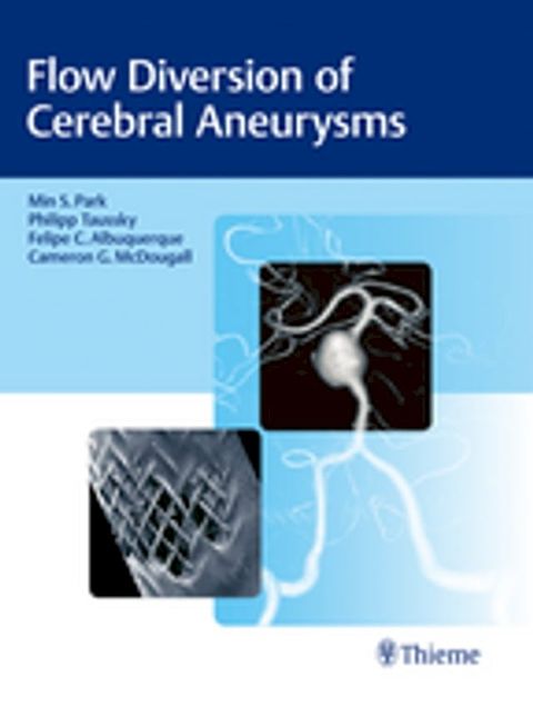 Flow Diversion of Cerebral Aneurysms(Kobo/電子書)