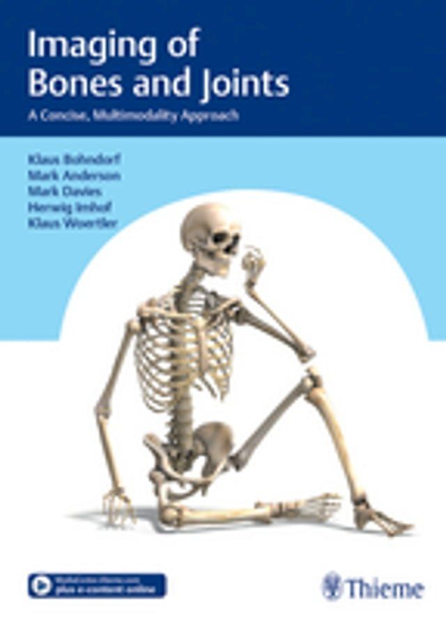  Imaging of Bones and Joints(Kobo/電子書)