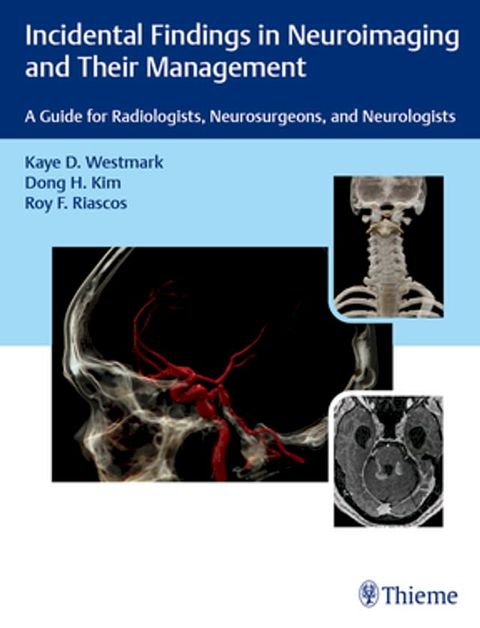 Incidental Findings in Neuroimaging and Their Management(Kobo/電子書)