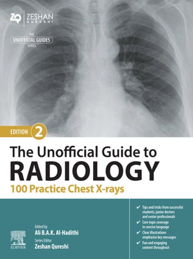  The Unofficial Guide to Radiology: 100 Practice Chest X-rays - E-Book(Kobo/電子書)