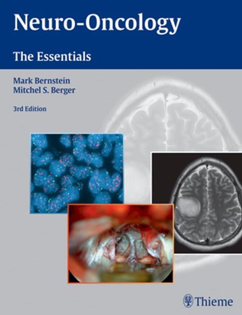 Neuro-Oncology: The Essentials(Kobo/電子書)