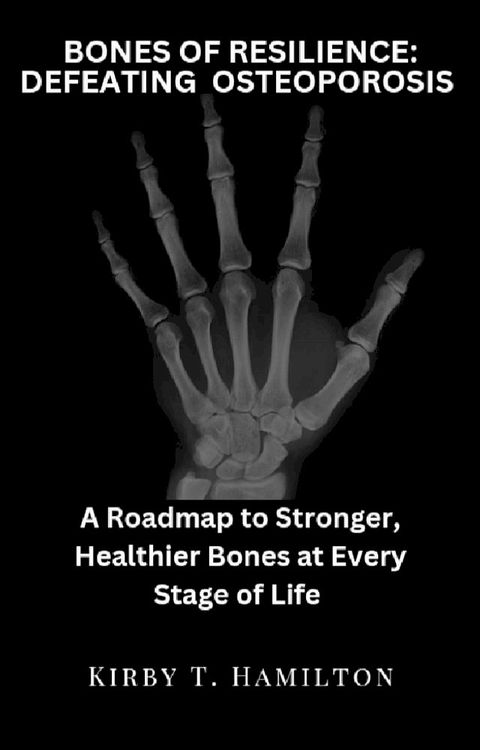 Bones of Resilience: Defeating Osteoporosis(Kobo/電子書)