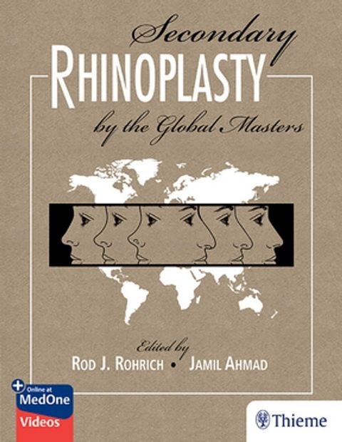 Secondary Rhinoplasty by the Global Masters(Kobo/電子書)