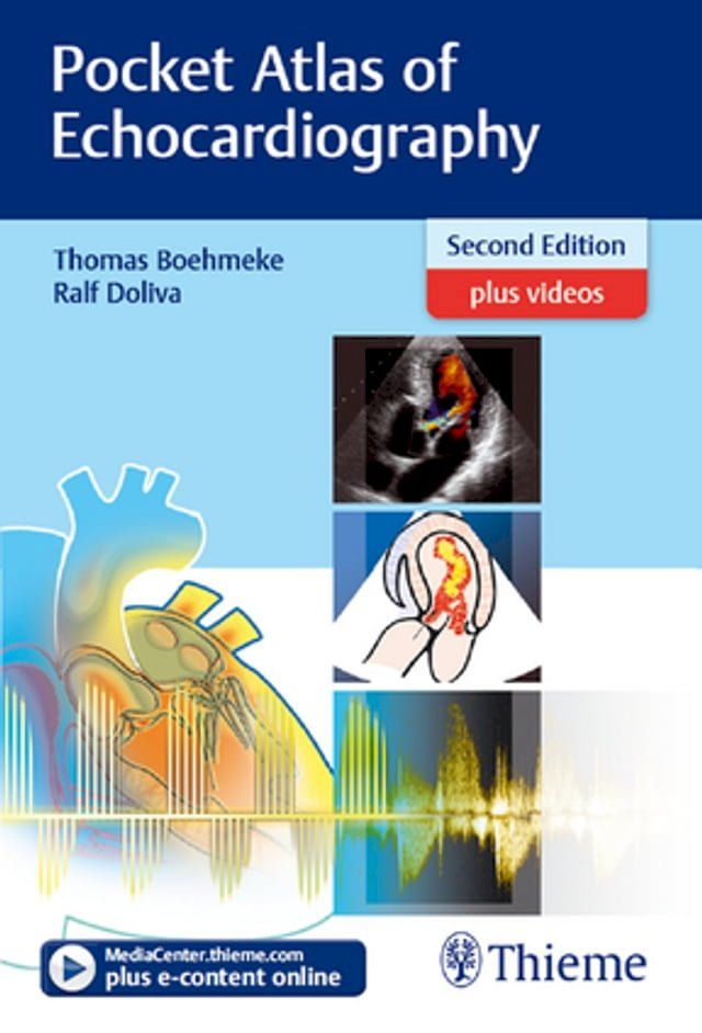  Pocket Atlas of Echocardiography(Kobo/電子書)