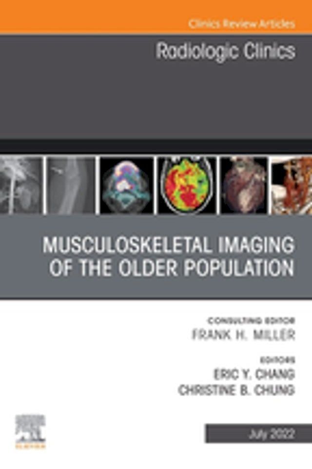  Musculoskeletal Imaging of the Older Population, An Issue of Radiologic Clinics of North America, E-Book(Kobo/電子書)