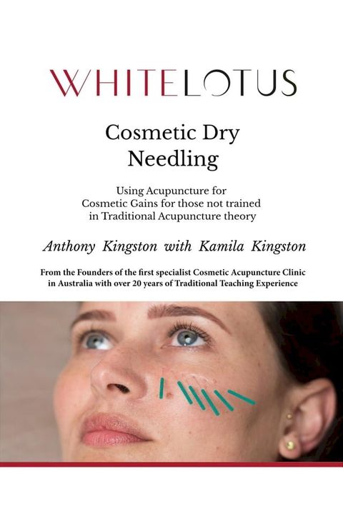 Cosmetic Dry Needling: Using Acupuncture for Cosmetic Gains for Those Not Trained in Traditional Acupuncture Theory(Kobo/電子書)