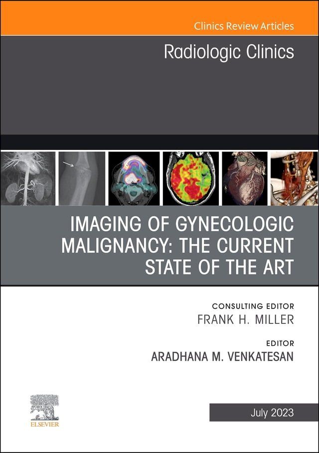  Imaging of Gynecologic Malignancy: The Current State of the Art, An Issue of Radiologic Clinics of North America, E-Book(Kobo/電子書)