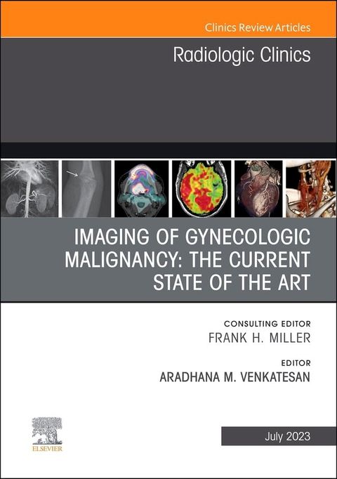 Imaging of Gynecologic Malignancy: The Current State of the Art, An Issue of Radiologic Clinics of North America, E-Book(Kobo/電子書)