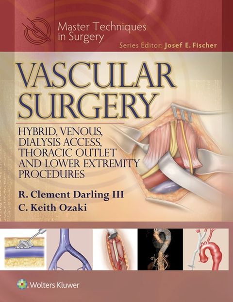 Master Techniques in Surgery: Vascular Surgery: Hybrid, Venous, Dialysis Access, Thoracic Outlet, and Lower Extremity Procedures(Kobo/電子書)