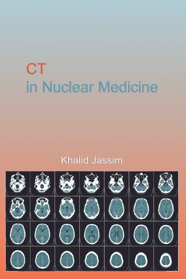  CT in Nuclear Medicine(Kobo/電子書)