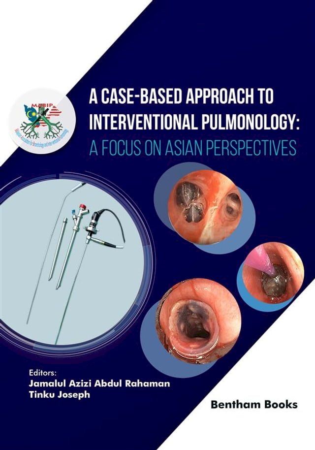  A Case-Based Approach to Interventional Pulmonology: A Focus on Asian Perspectives(Kobo/電子書)