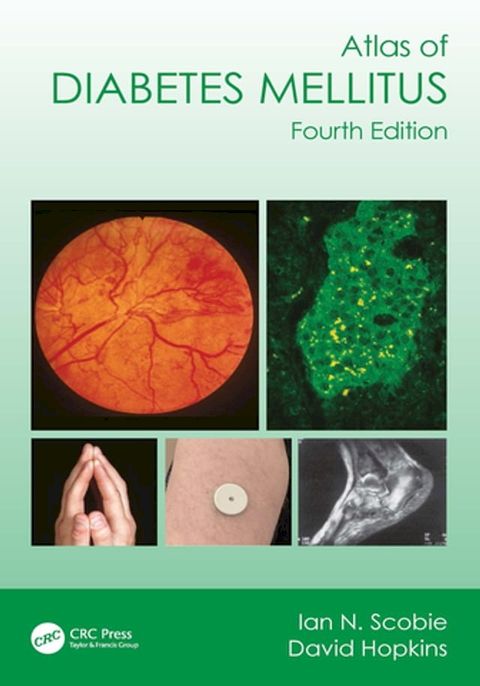 Atlas of Diabetes Mellitus(Kobo/電子書)