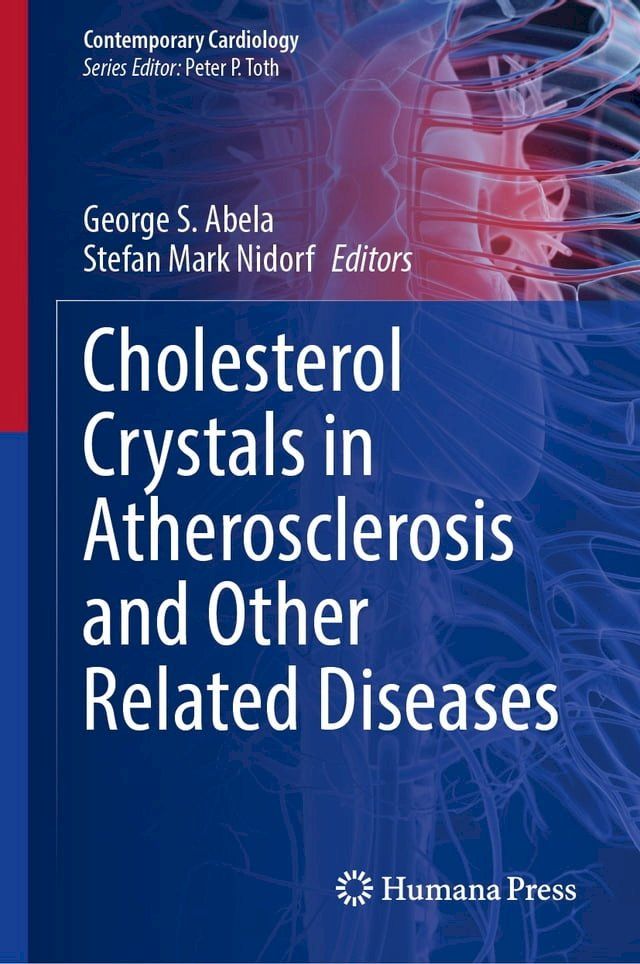  Cholesterol Crystals in Atherosclerosis and Other Related Diseases(Kobo/電子書)