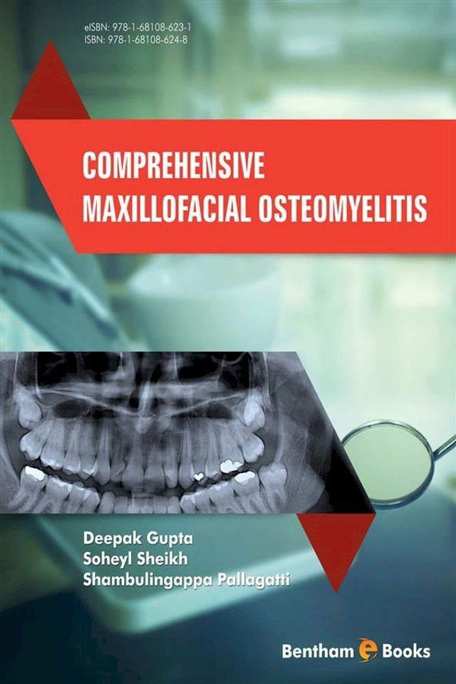  Comprehensive Maxillofacial Osteomyelitis(Kobo/電子書)