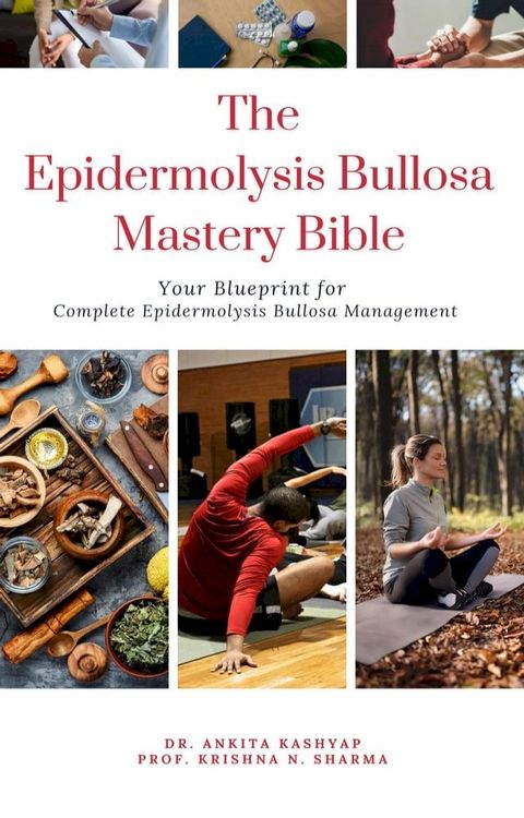 The Epidermolysis Bullosa Mastery Bible: Your Blueprint for Complete Epidermolysis Bullosa Management(Kobo/電子書)