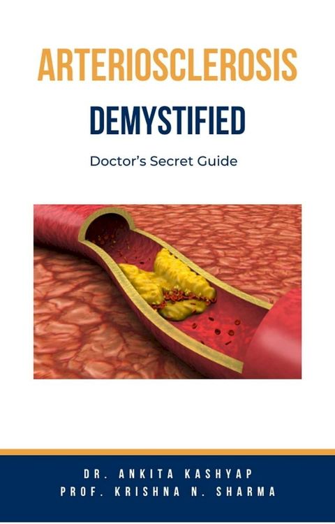 Arteriosclerosis Demystified: Doctor’s Secret Guide(Kobo/電子書)