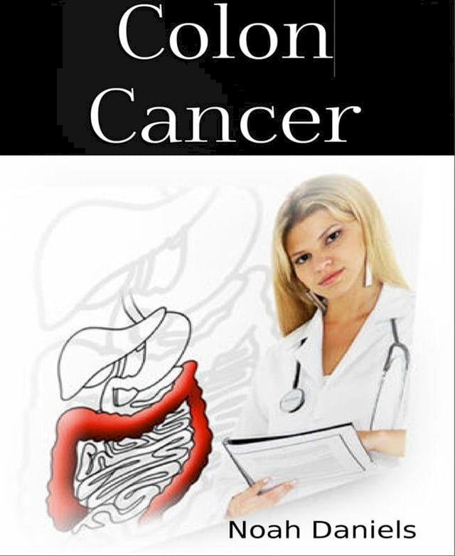  Colon Cancer(Kobo/電子書)