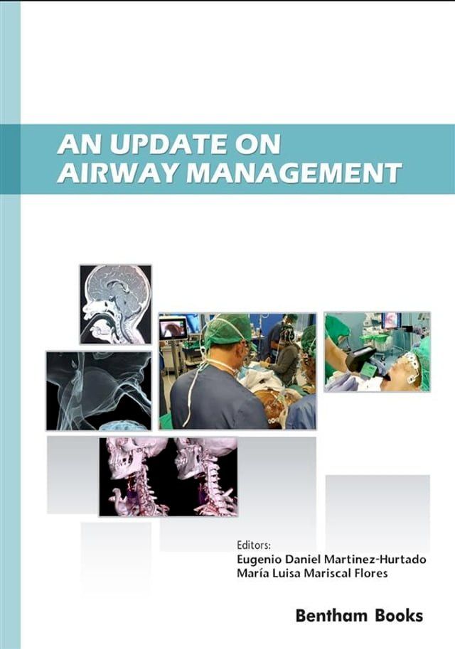  An Update on Airway Management(Kobo/電子書)