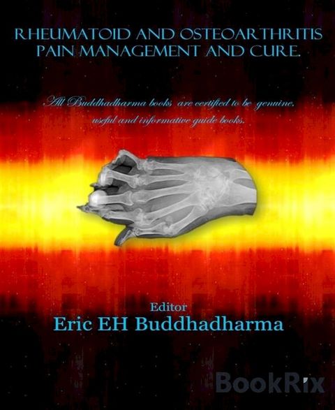 Rheumatoid and osteoarthritis pain management and cure.(Kobo/電子書)