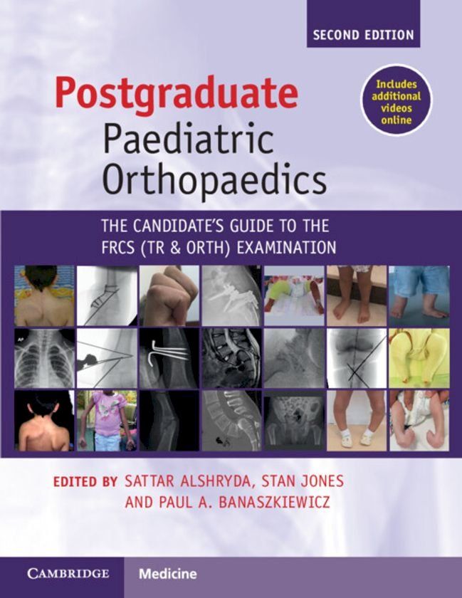  Postgraduate Paediatric Orthopaedics(Kobo/電子書)