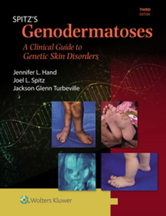  Spitz's Genodermatoses(Kobo/電子書)