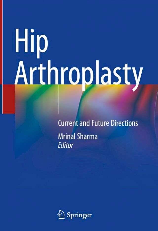  Hip Arthroplasty(Kobo/電子書)