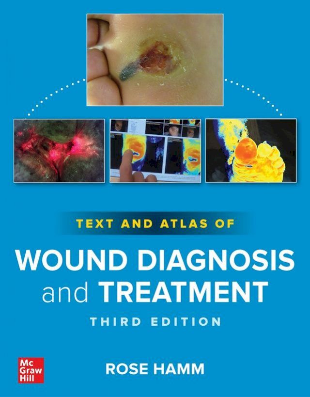  Text and Atlas of Wound Diagnosis and Treatment, Third Edition(Kobo/電子書)