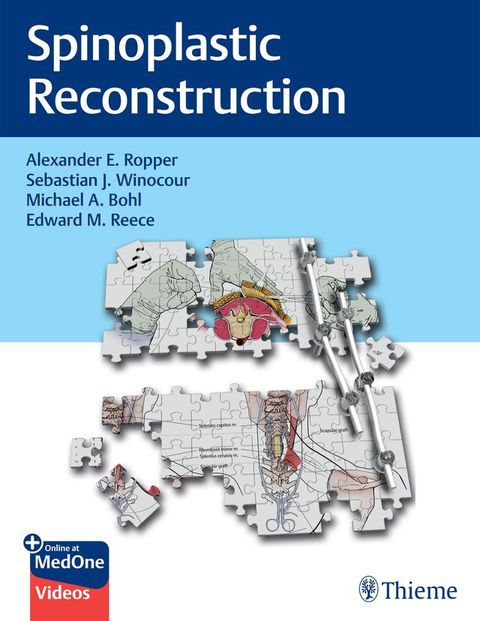 Spinoplastic Reconstruction(Kobo/電子書)