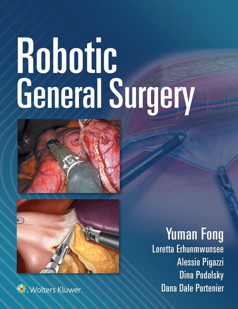 Robotic General Surgery(Kobo/電子書)