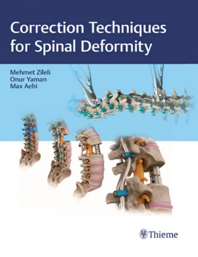  Correction Techniques for Spinal Deformity(Kobo/電子書)