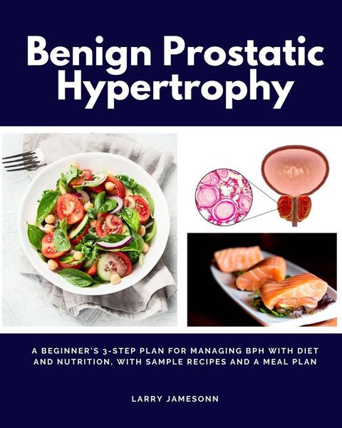 Benign Prostatic Hypertrophy(Kobo/電子書)