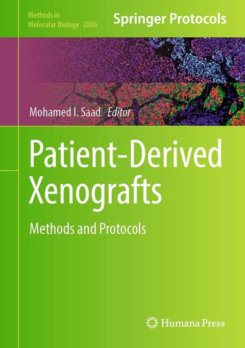 Patient-Derived Xenografts(Kobo/電子書)