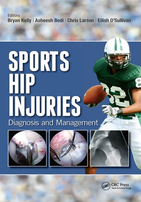 Sports Hip Injuries(Kobo/電子書)